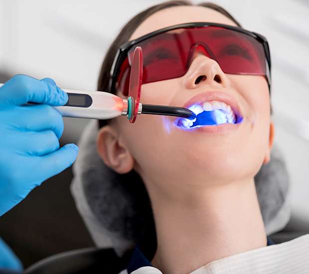 San Juan Capistrano Professional Teeth Whitening